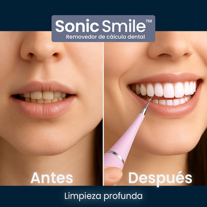 SmilePro™ – Limpieza Profunda y Sonrisa Saludable🦷😁